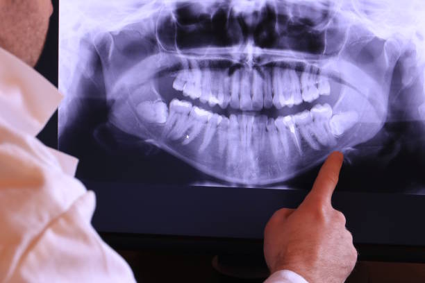 Best Walk-In Emergency Dental Services in Stallion Springs, CA