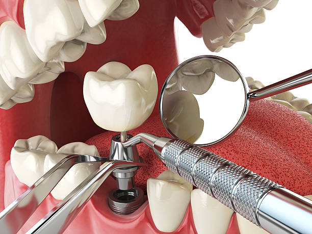 Best Weekend Emergency Dental Services in Stallion Springs, CA